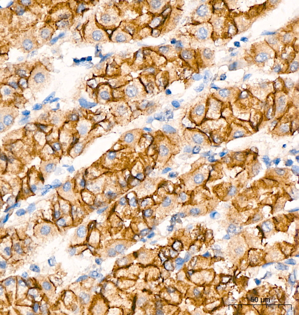 E-Cadherin Rabbit mAb