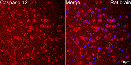 Caspase-12 Rabbit mAb