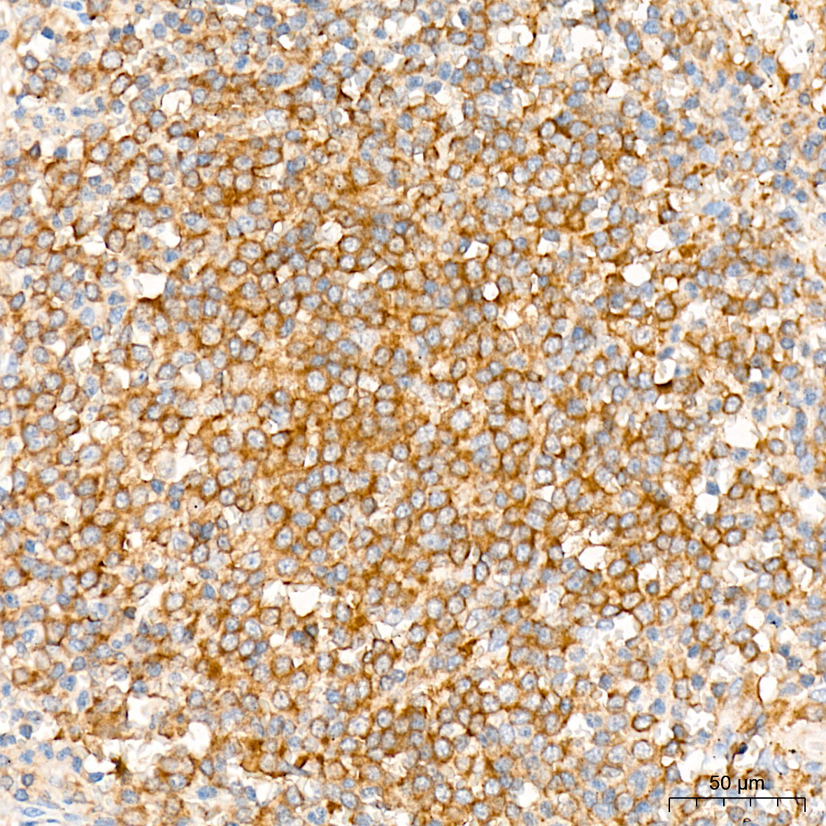 [KD Validated] NF2/Merlin Rabbit mAb