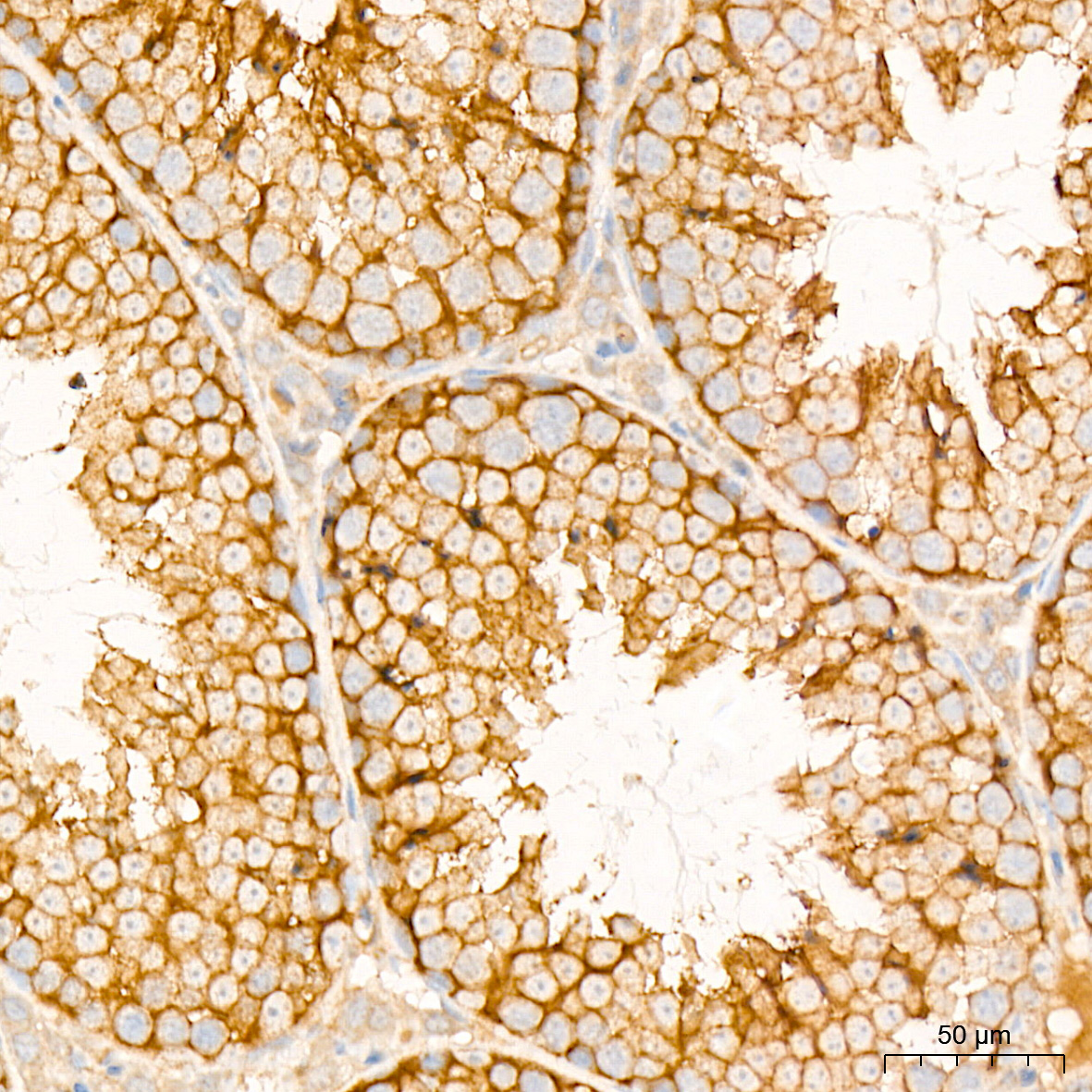 [KD Validated] NF2/Merlin Rabbit mAb