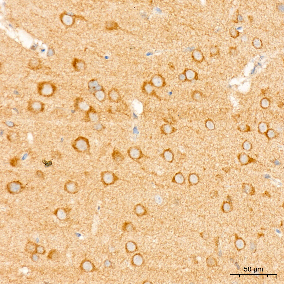 [KD Validated] NF2/Merlin Rabbit mAb