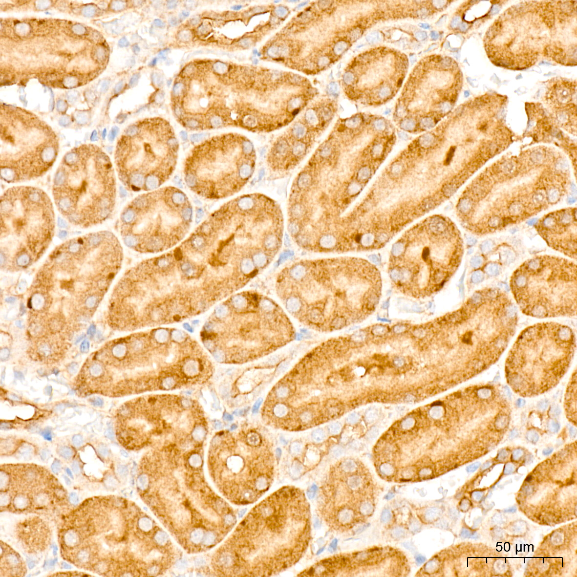 [KD Validated] NF2/Merlin Rabbit mAb