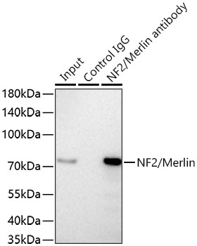 [KD Validated] NF2/Merlin Rabbit mAb