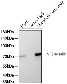 [KD Validated] NF2/Merlin Rabbit mAb