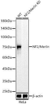 [KD Validated] NF2/Merlin Rabbit mAb