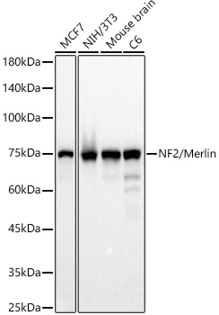 [KD Validated] NF2/Merlin Rabbit mAb