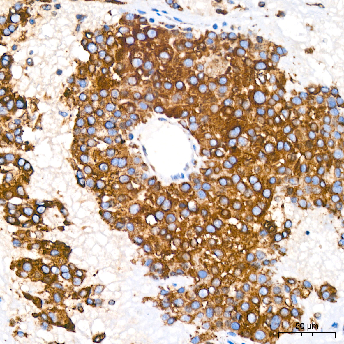 BiP/GRP78 Rabbit mAb