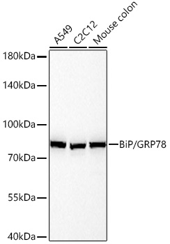 BiP/GRP78 Rabbit mAb