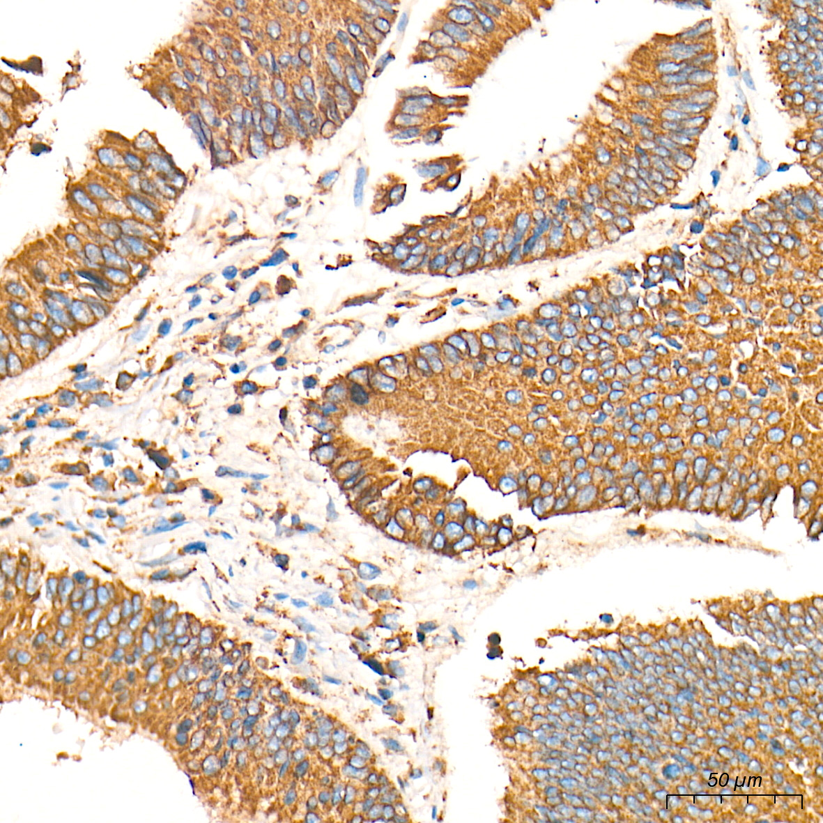 BiP/GRP78 Rabbit mAb