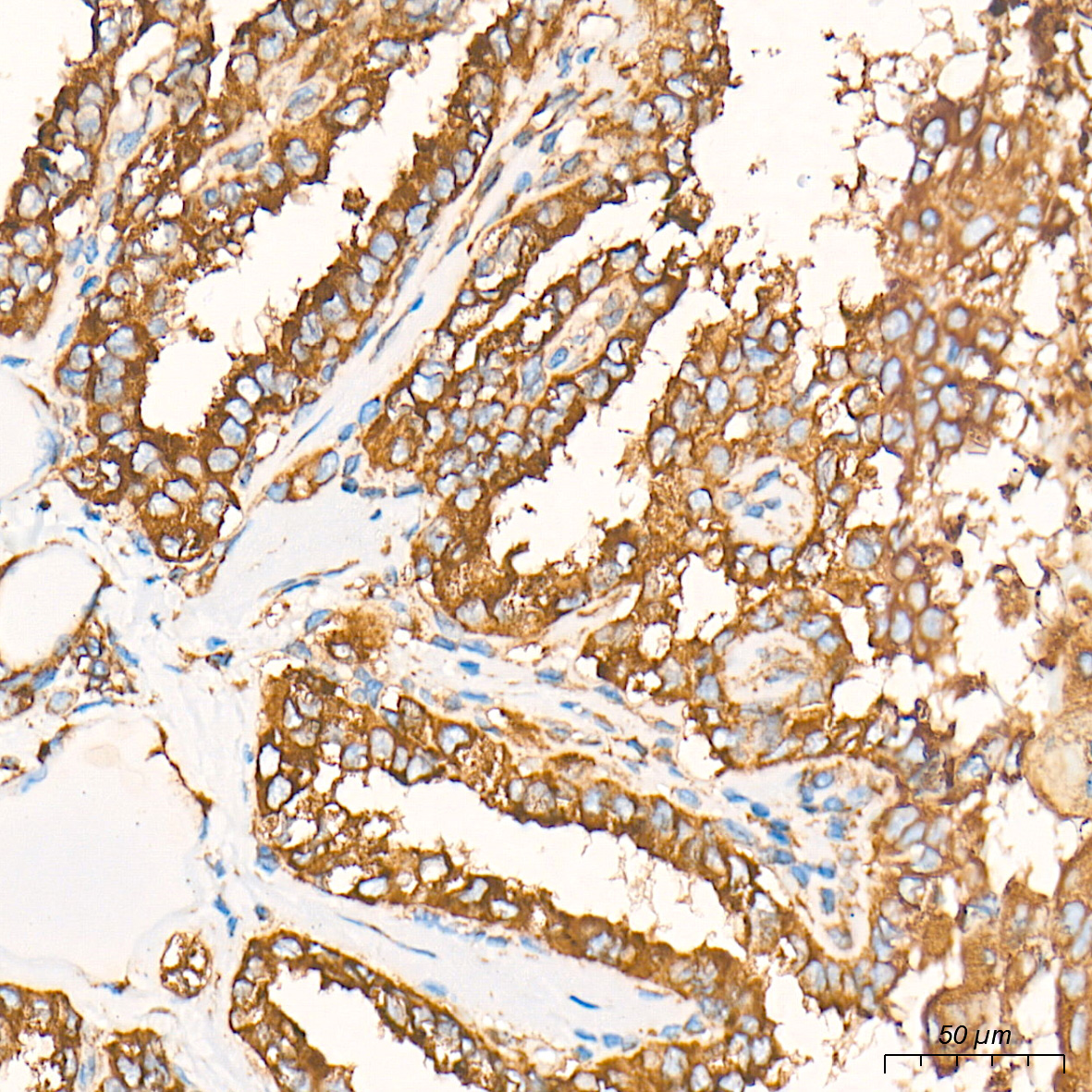 BiP/GRP78 Rabbit mAb
