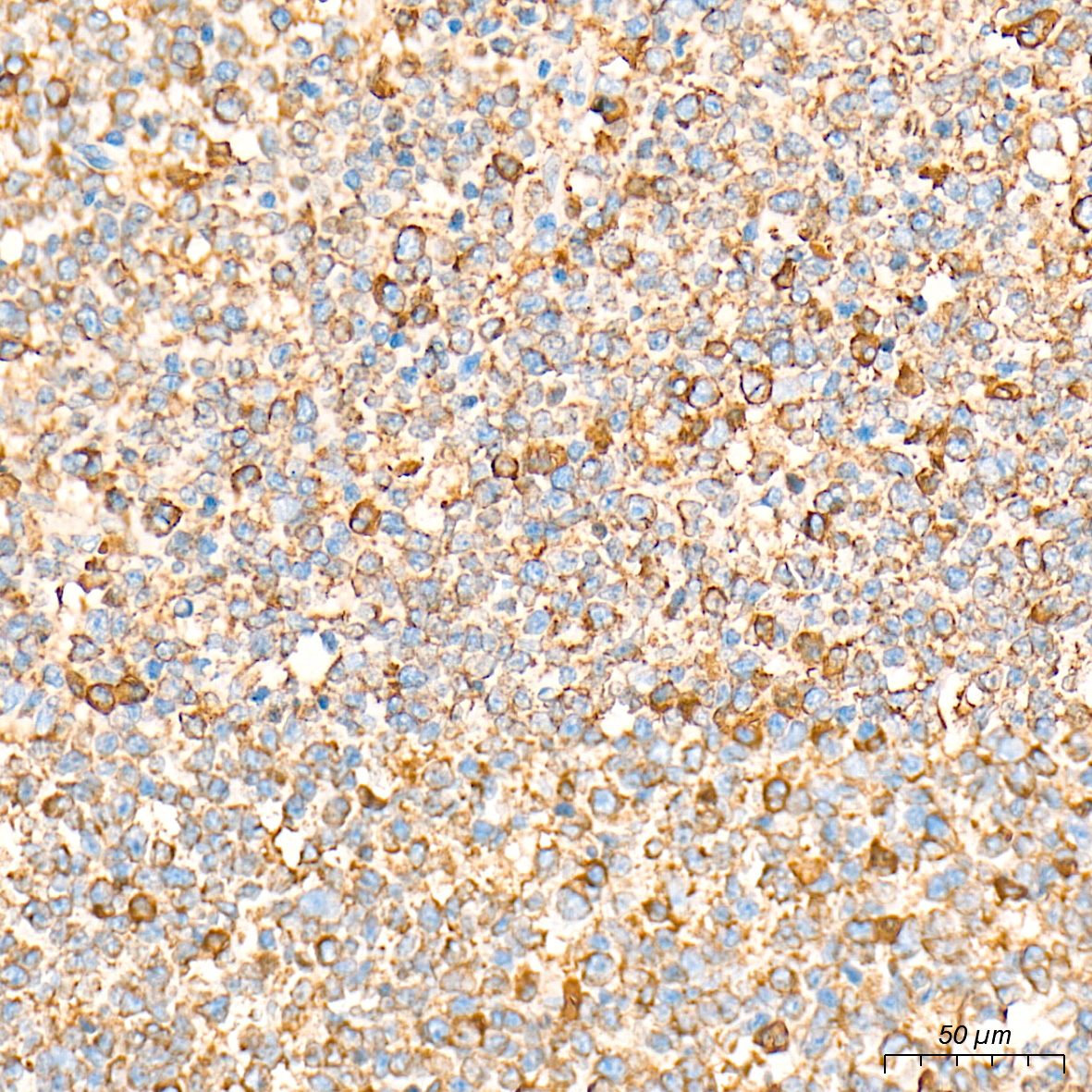 BiP/GRP78 Rabbit mAb