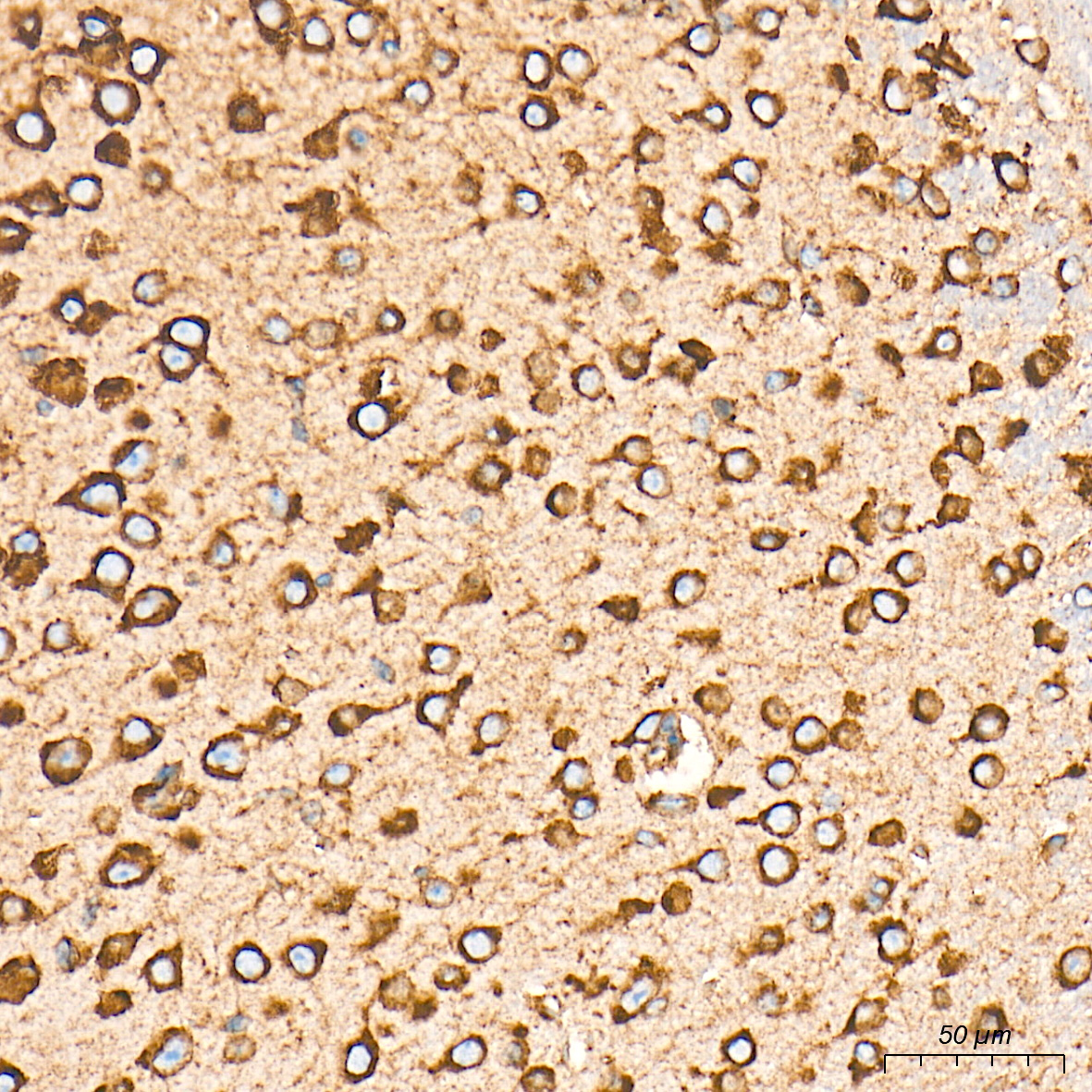 BiP/GRP78 Rabbit mAb