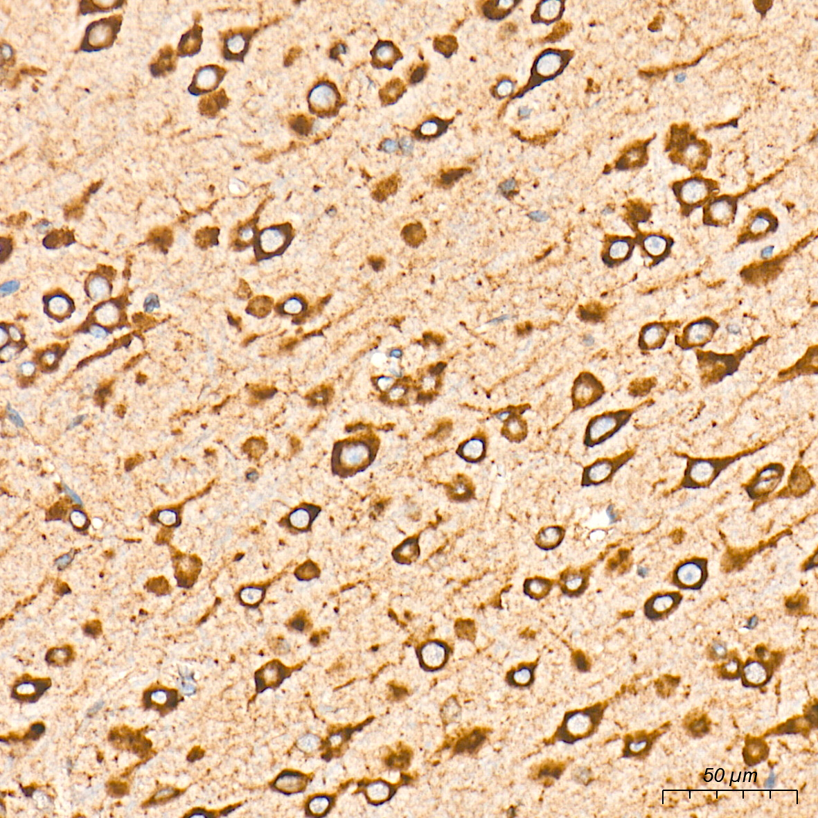 BiP/GRP78 Rabbit mAb