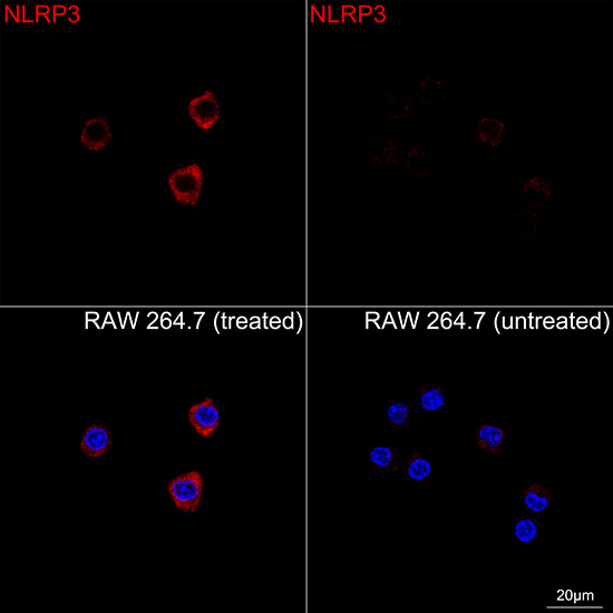 NLRP3 Rabbit mAb