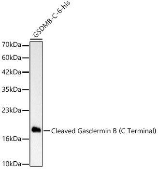 Cleaved Gasdermin B（C Terminal） Rabbit mAb