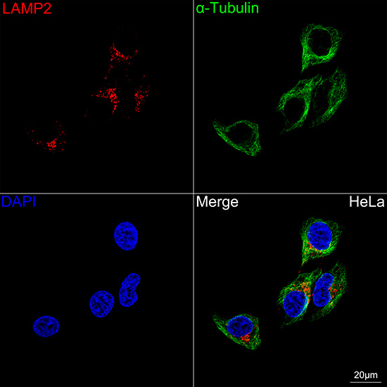 [KO Validated] LAMP2 Rabbit mAb