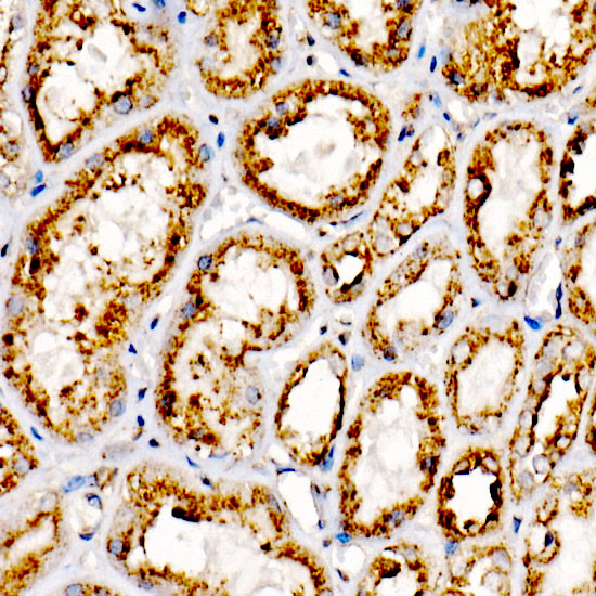 [KO Validated] LAMP2 Rabbit mAb