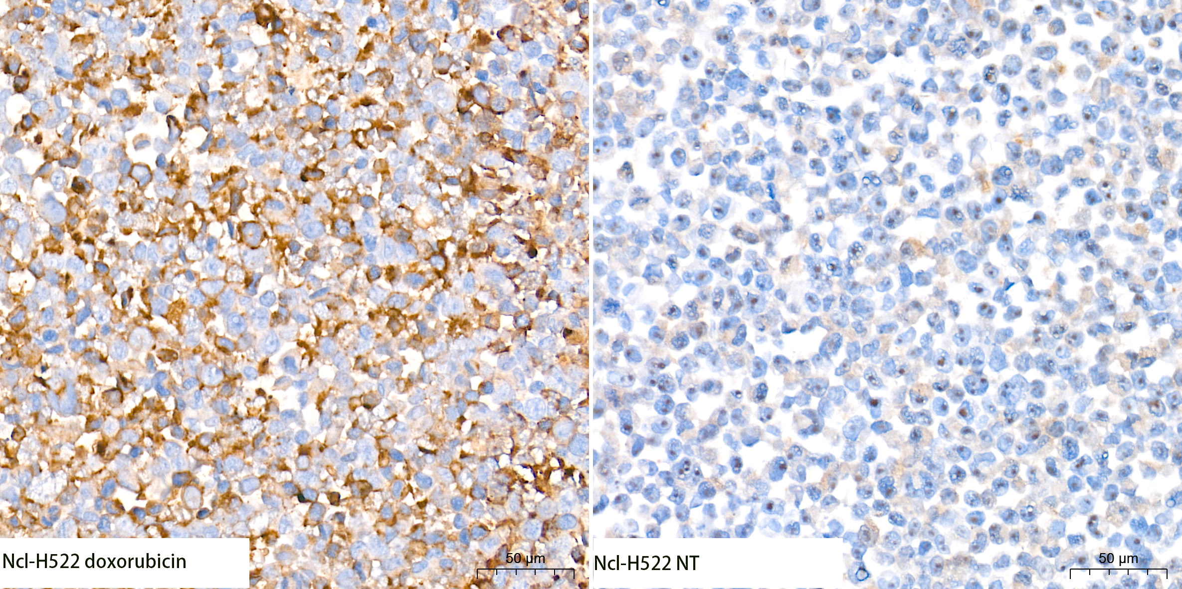 [KO Validated] Cleaved Gasdermin E (N terminal) Rabbit mAb
