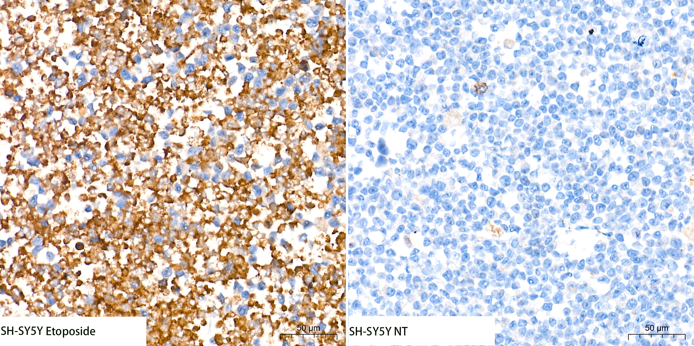 [KO Validated] Cleaved Gasdermin E (N terminal) Rabbit mAb