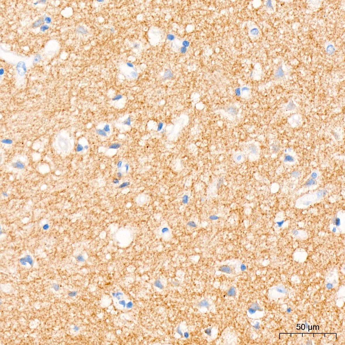 TrkA+B+C Rabbit mAb