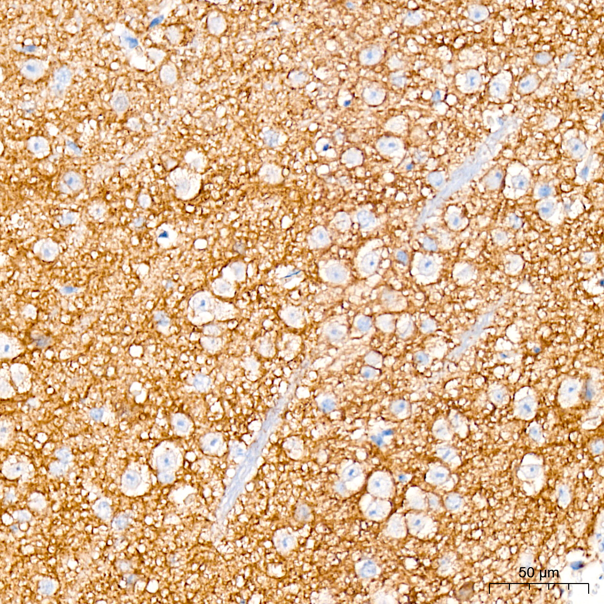 TrkA+B+C Rabbit mAb