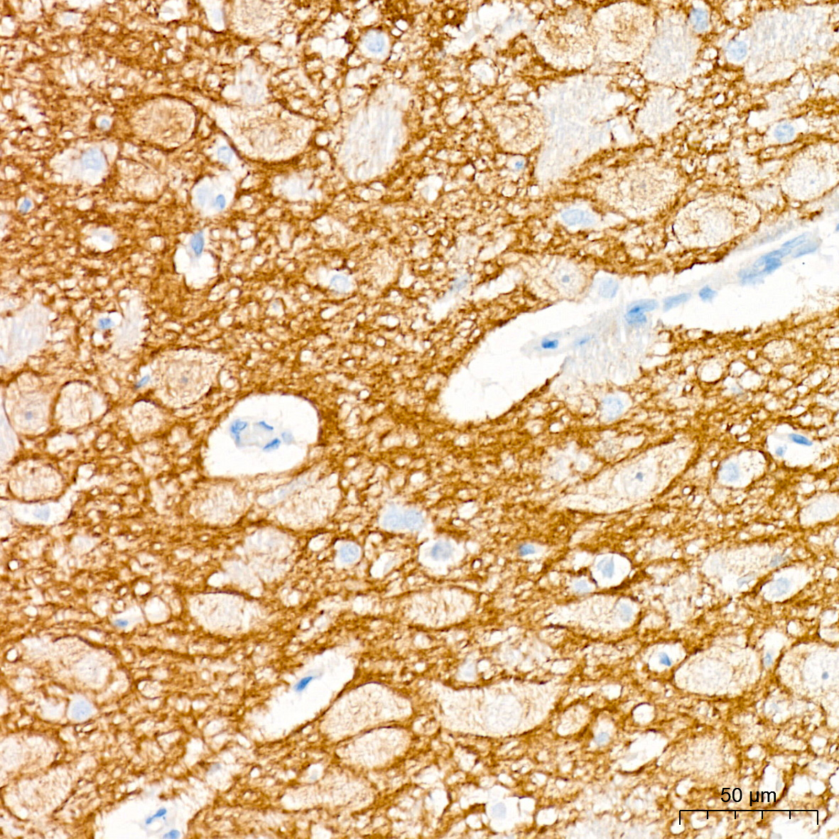 TrkA+B+C Rabbit mAb