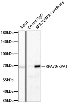 RPA70/RPA1 Rabbit mAb