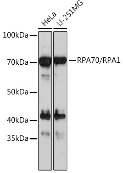 RPA70/RPA1 Rabbit mAb