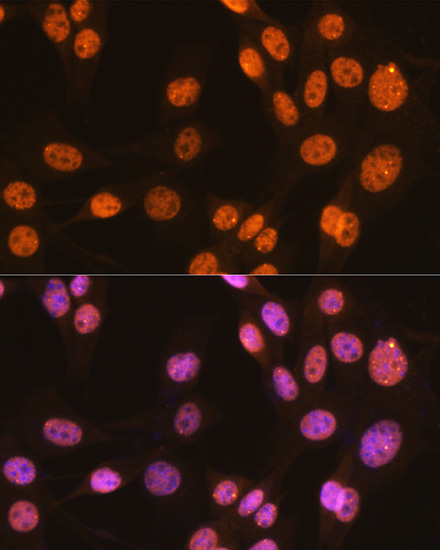PTBP1 Rabbit mAb
