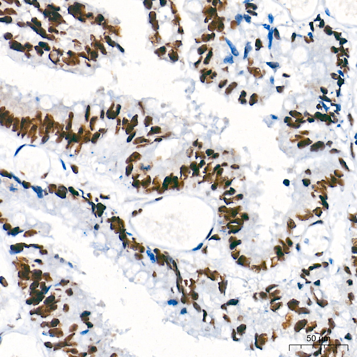 PTBP1 Rabbit mAb