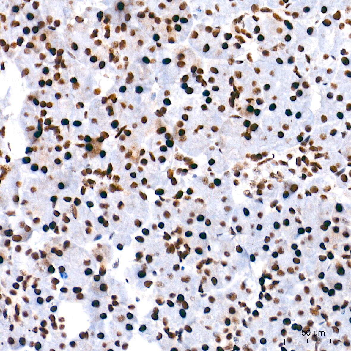 PTBP1 Rabbit mAb