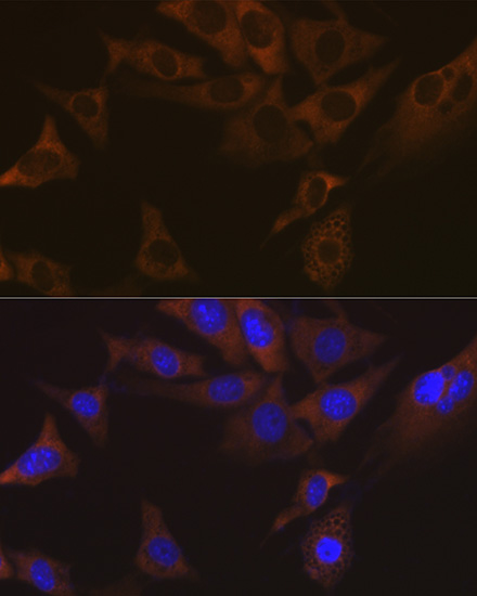 VAMP1 Rabbit mAb