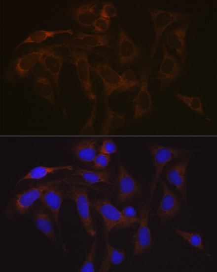 VAMP1 Rabbit mAb
