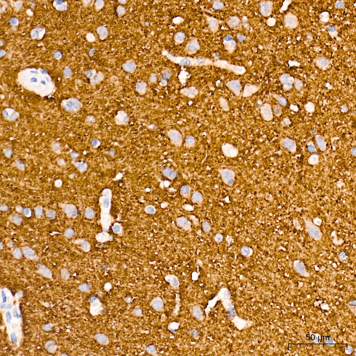 VAMP1 Rabbit mAb