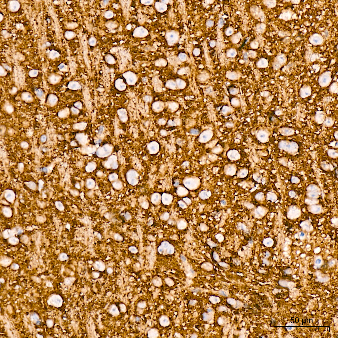 VAMP1 Rabbit mAb