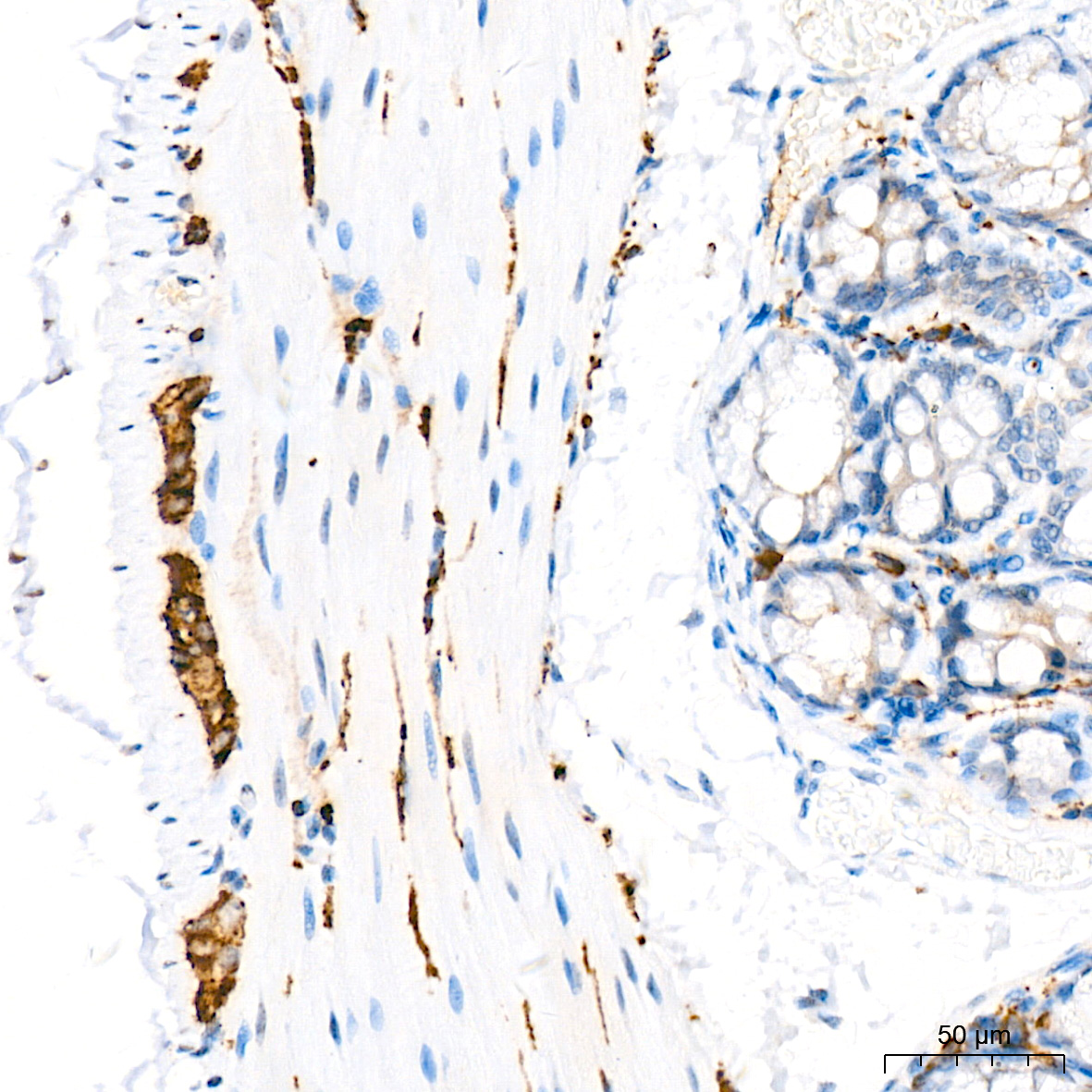 VAMP1 Rabbit mAb