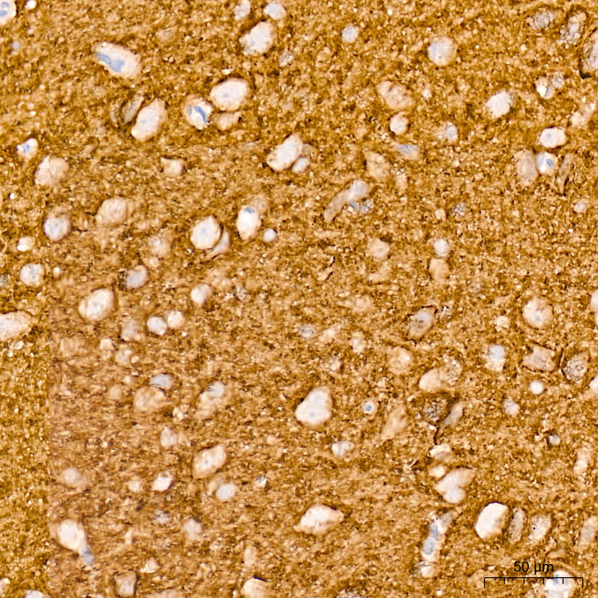 VAMP1 Rabbit mAb