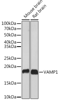 VAMP1 Rabbit mAb