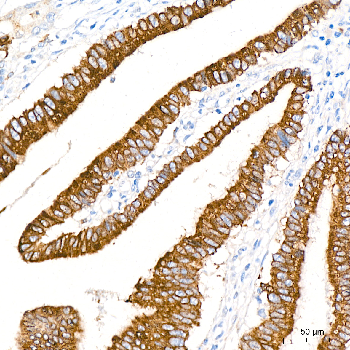 COX2/PTGS2 Rabbit mAb