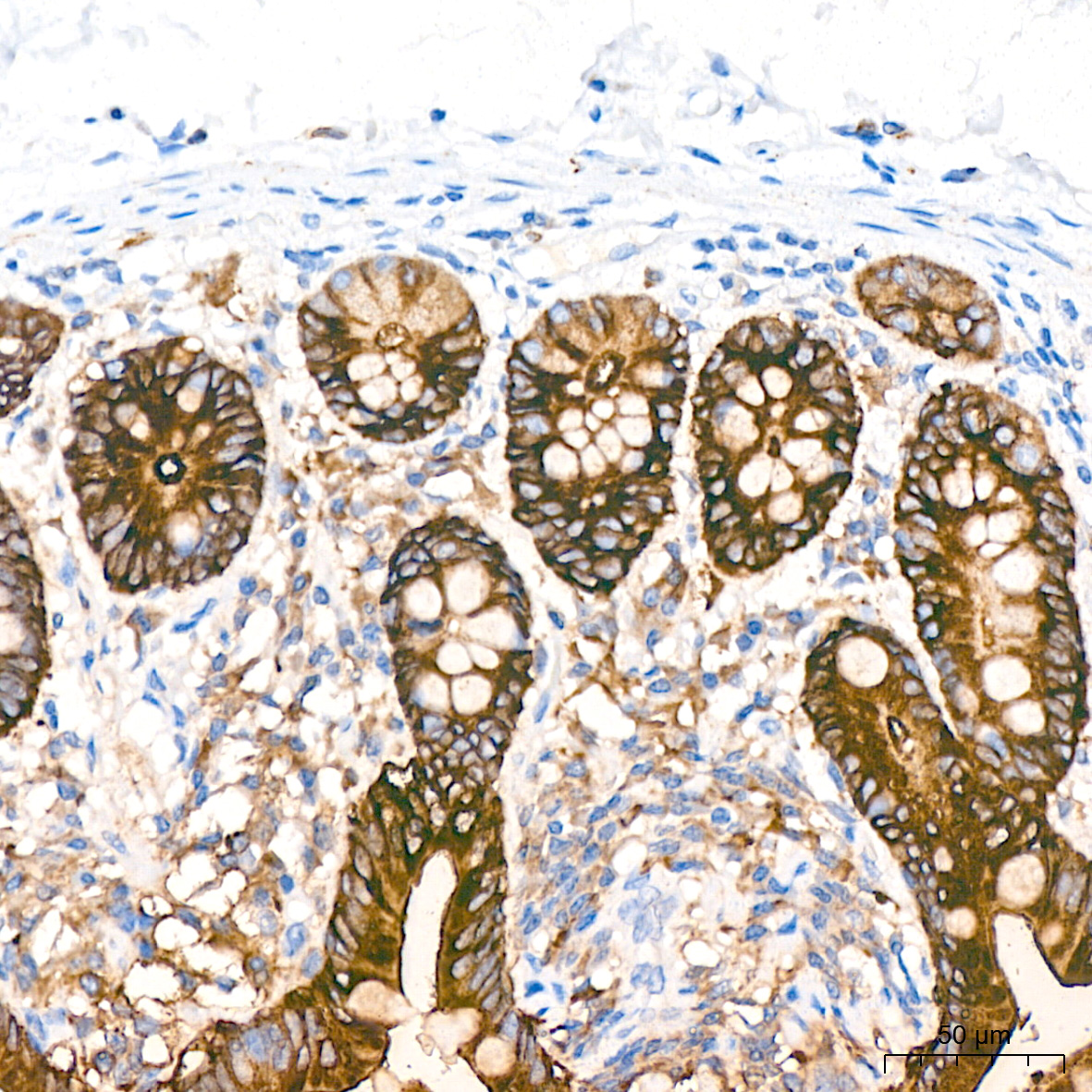 COX2/PTGS2 Rabbit mAb