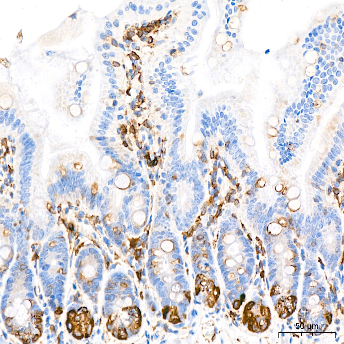 COX2/PTGS2 Rabbit mAb