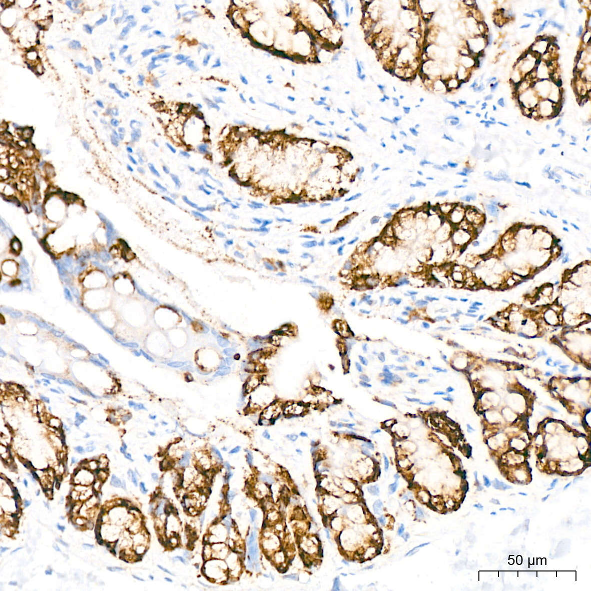 COX2/PTGS2 Rabbit mAb