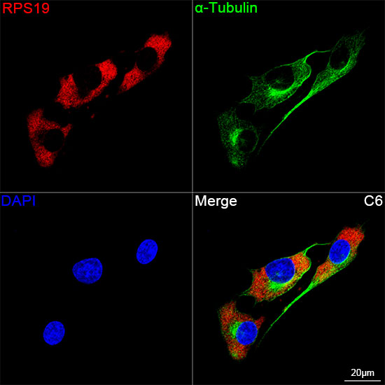RPS19 Rabbit mAb