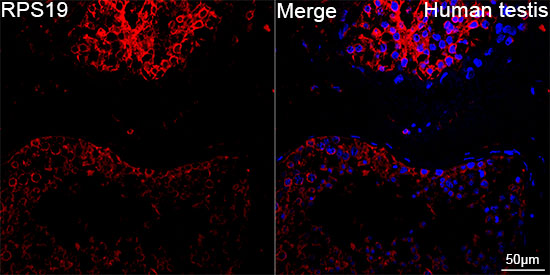 RPS19 Rabbit mAb
