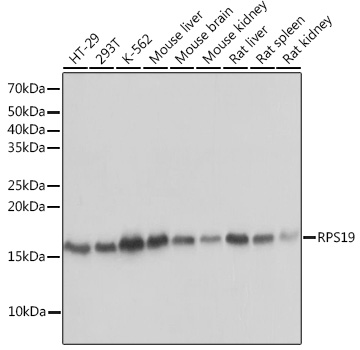 RPS19 Rabbit mAb