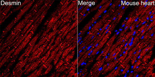 Desmin Rabbit mAb