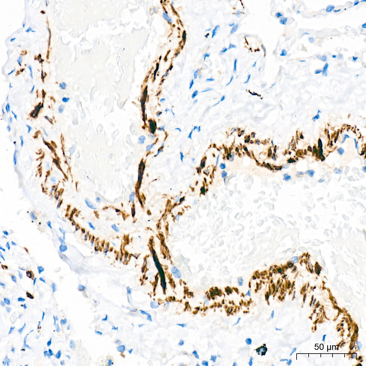 Desmin Rabbit mAb