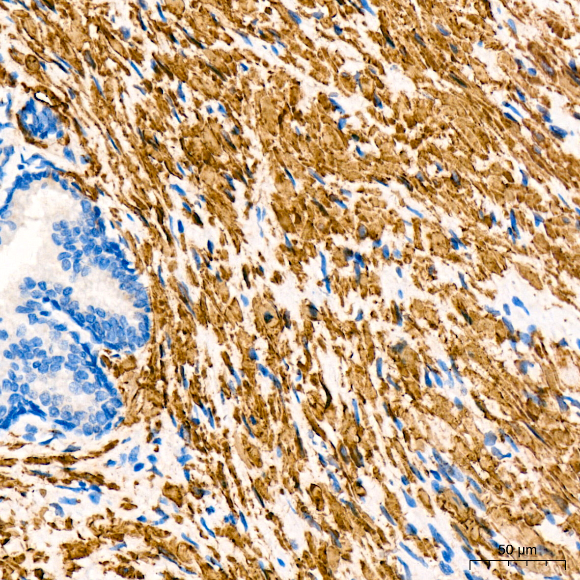 Desmin Rabbit mAb