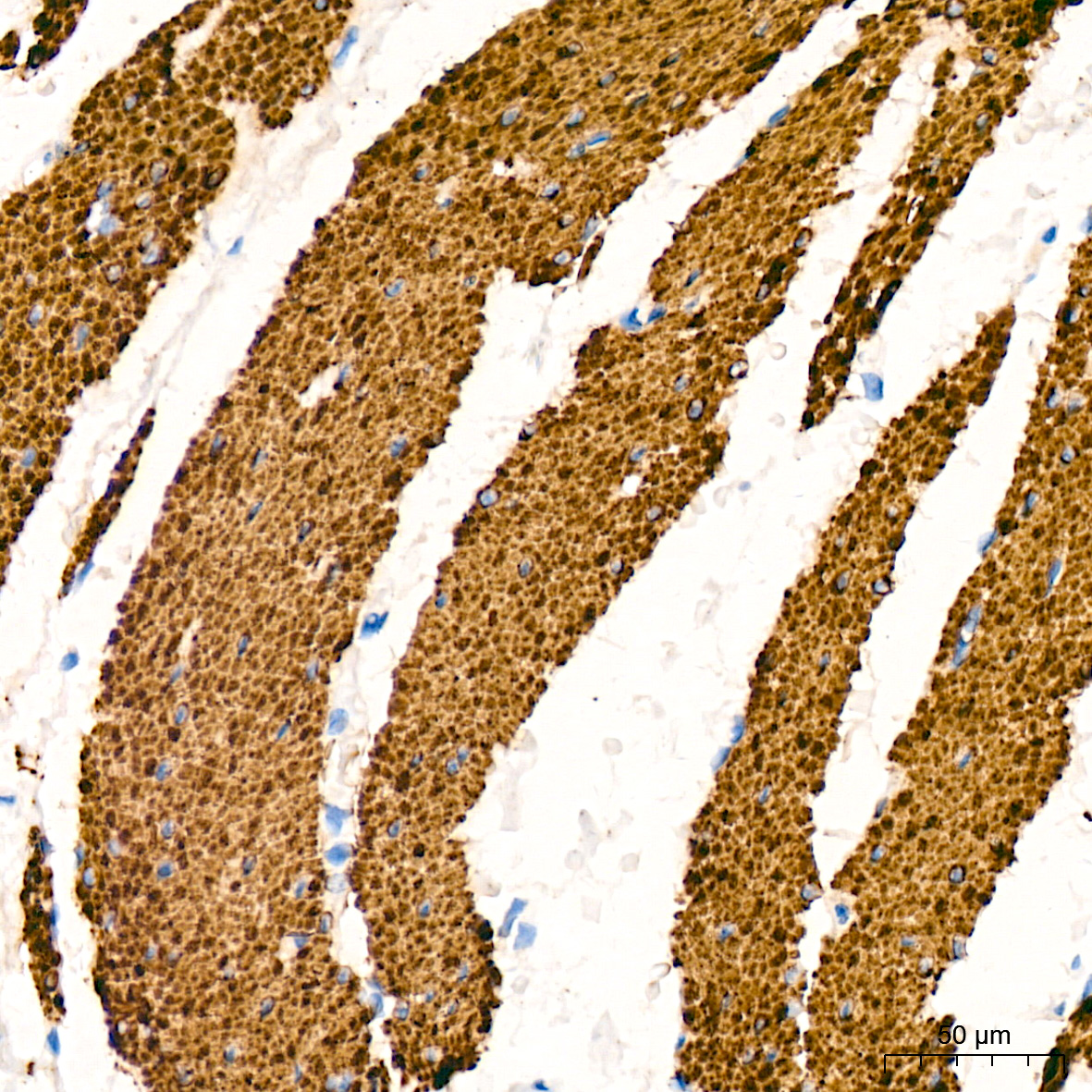 Desmin Rabbit mAb