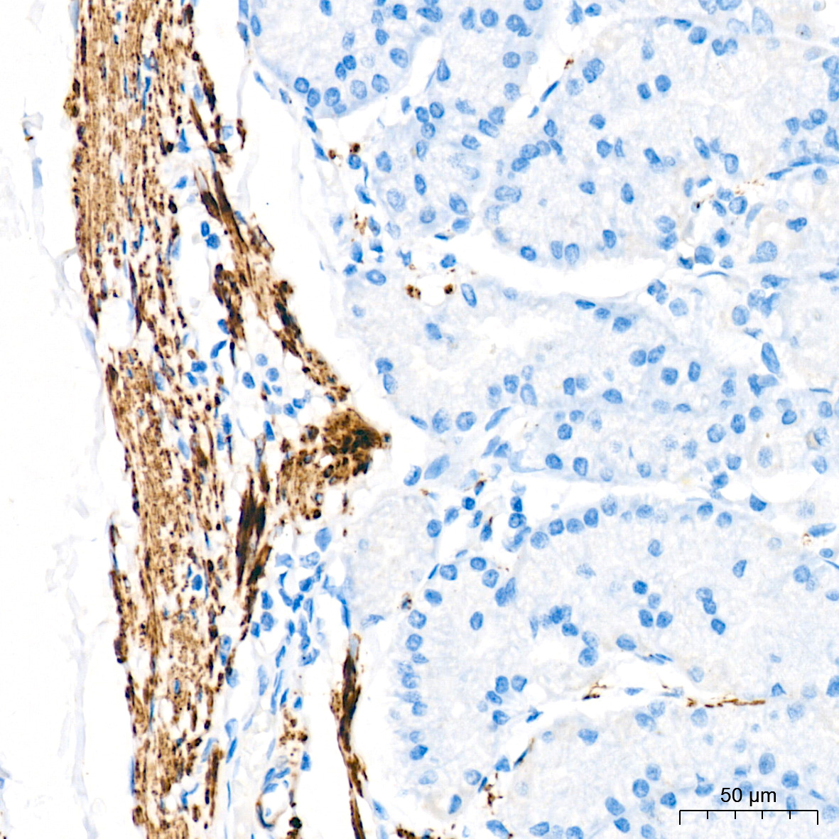 Desmin Rabbit mAb